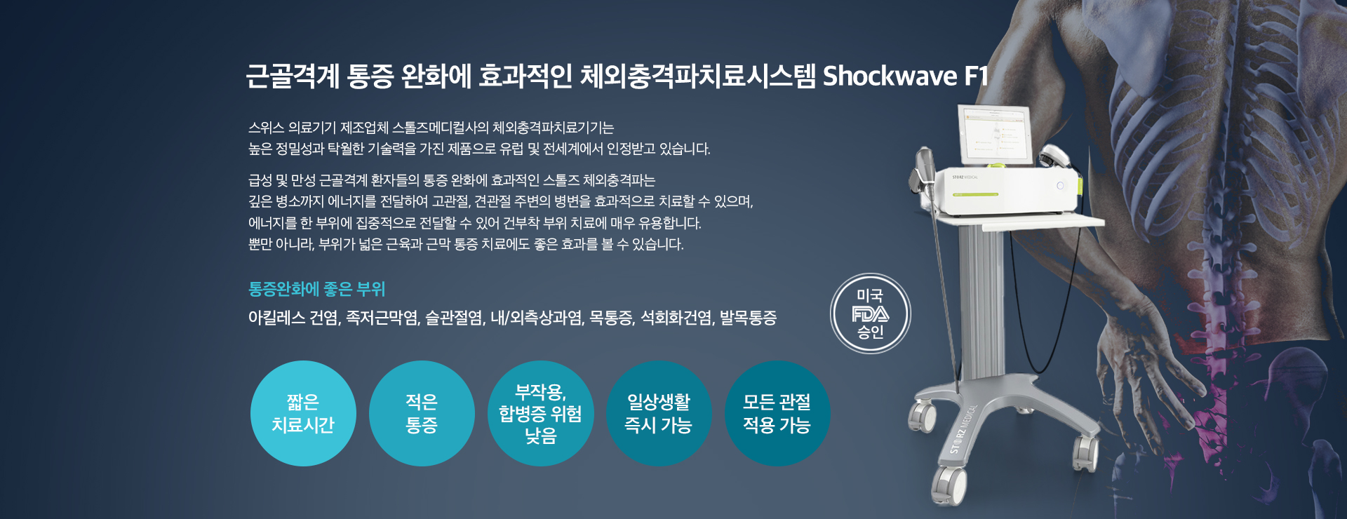 체외충격파